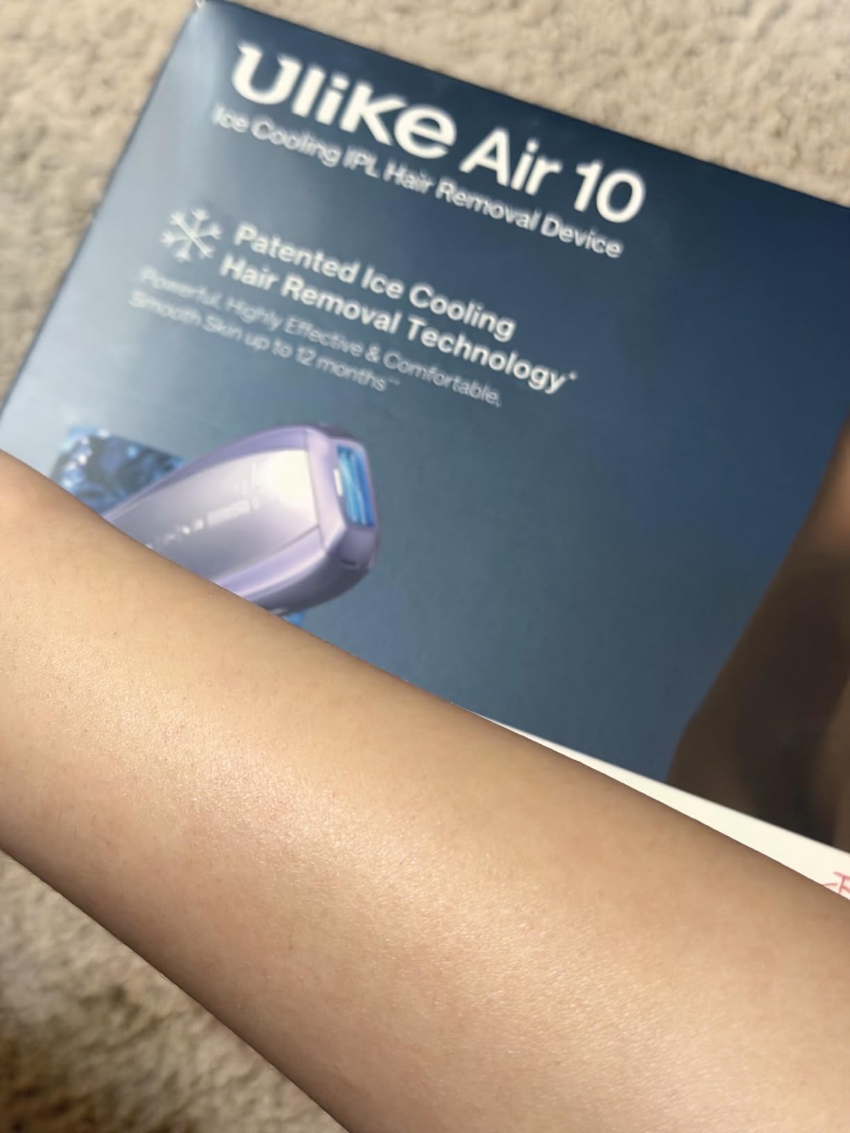 Ulike Laser HR Air 10 Deluxe Version IPL with Ice-Cooling customer photo 2