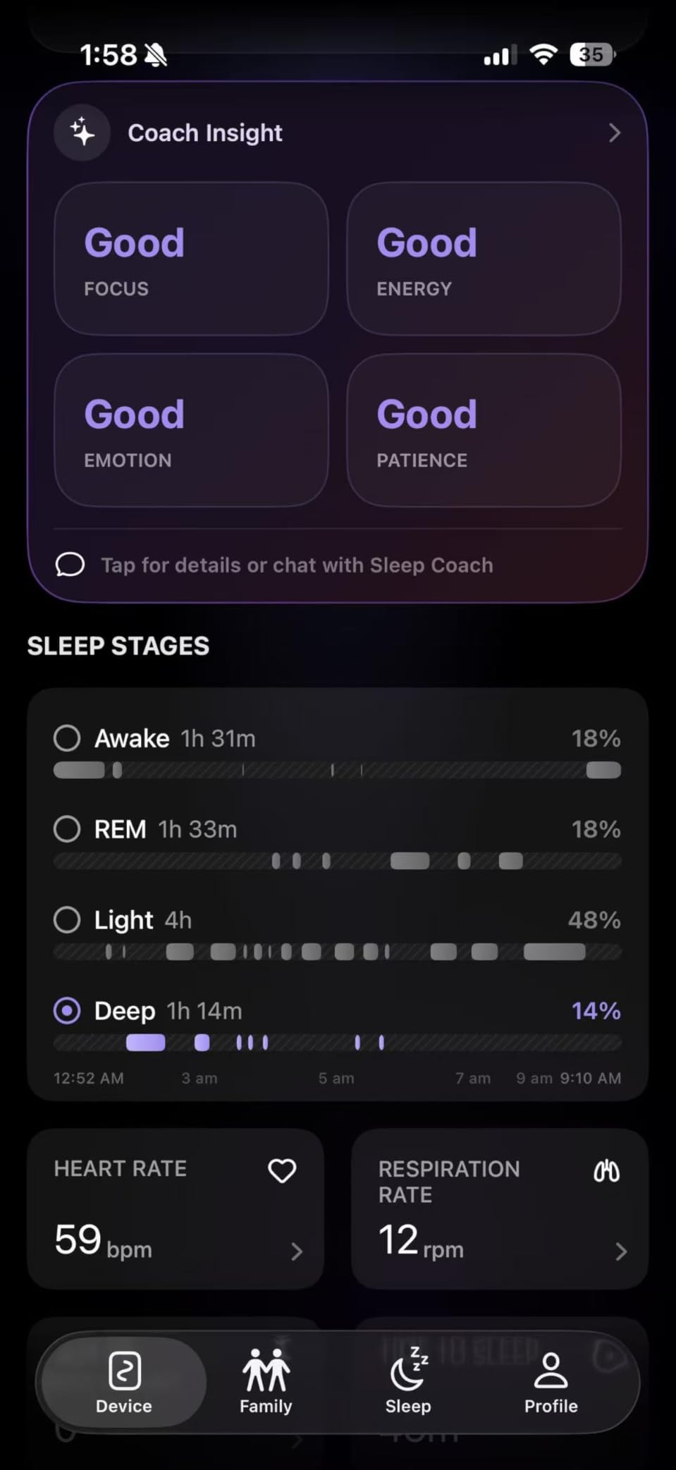 Non-Wearable Contactless Sleep Tracker & Sleep Monitor Device for Adults and Kids | No Subscription, Heart Rate, Breathing & Sleep Stage, Real-Time Monitoring, Smart Alarm customer photo 1