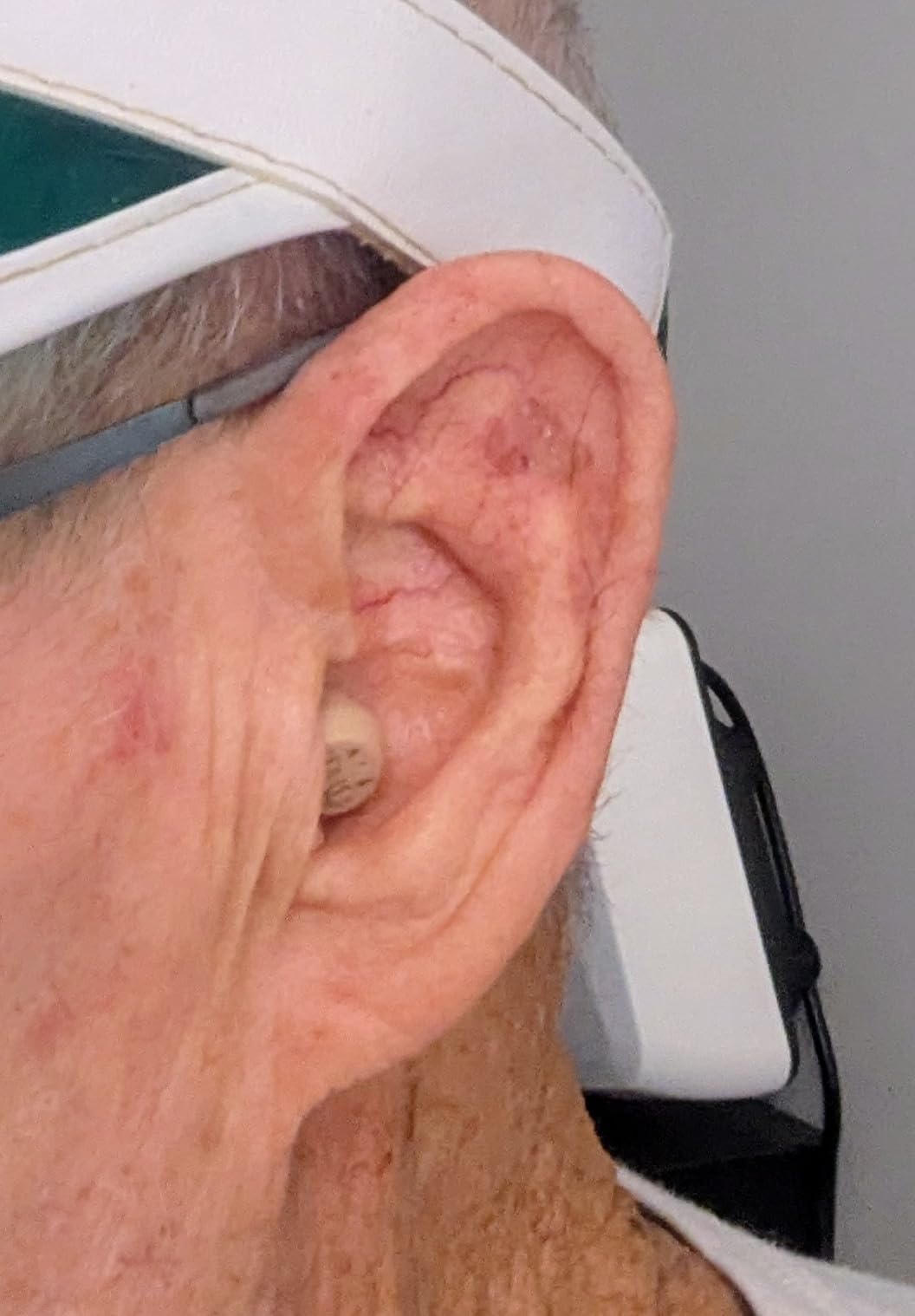 Audien Atom One OTC Hearing Aids - Wireless, Rechargeable, and Comfortable | Clear Sound in a Small, Discreet Design for Seniors & Adults with Hearing Loss customer photo 1