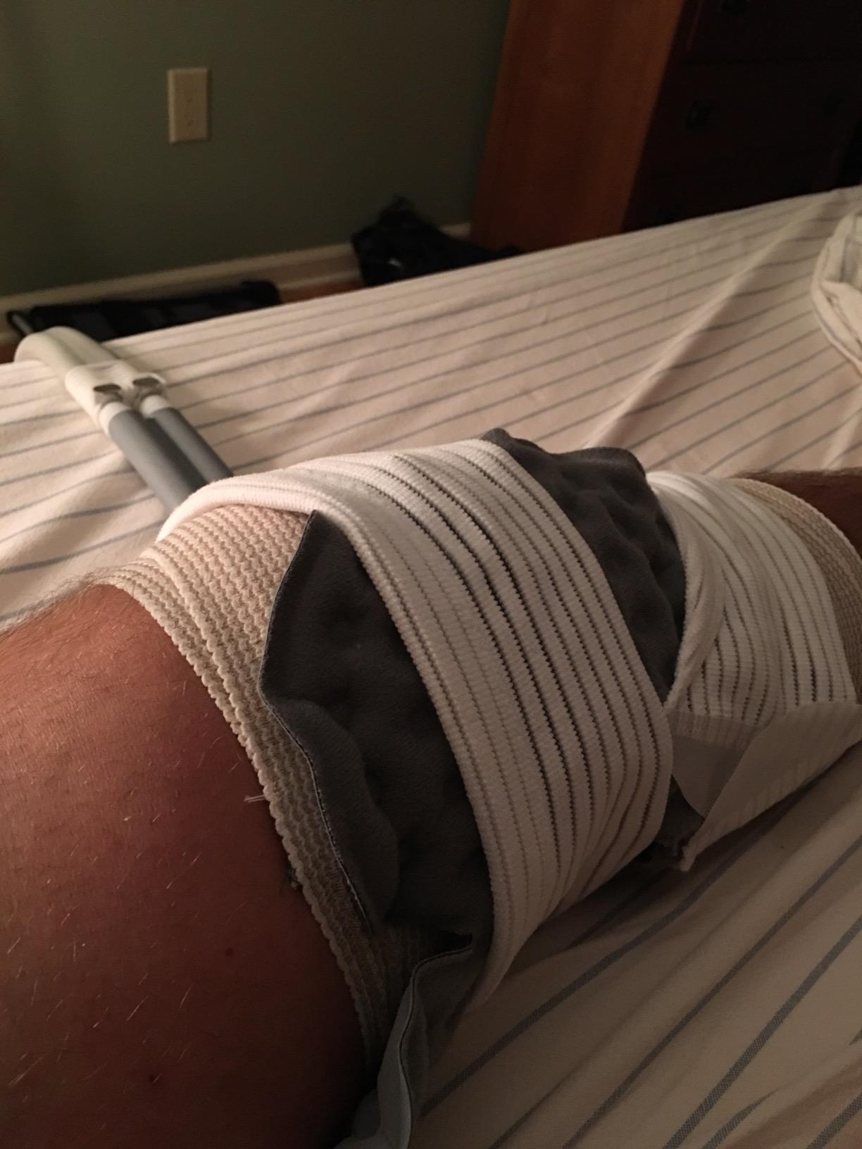 Cold Rush Compact Therapy Ice Machine - Cryotherapy System for Pain Relief & Cold Compression - Post-Surgery & Injury Recovery - with Replacement Cryo Cuff Pads (with Shoulder Pad Large) customer photo 2