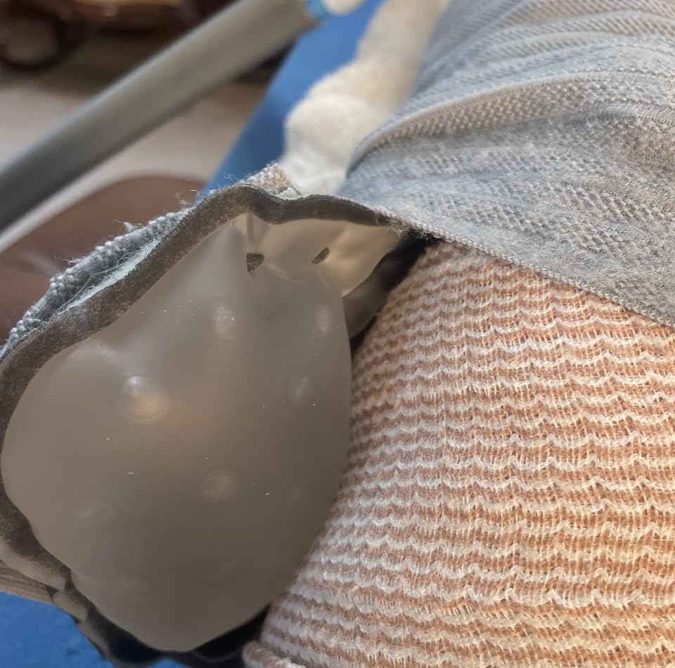 DonJoy Iceman CLASSIC3 Cold Therapy Unit customer photo 1