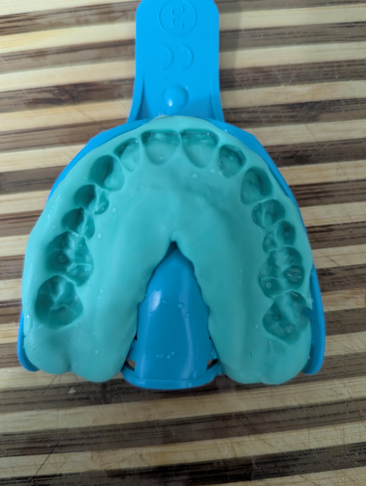 Encore - Custom Dental Night Guard/Mouth Guard for Protection Against Teeth Grinding/Clenching/Bruxism - One (1) Guards customer photo 2