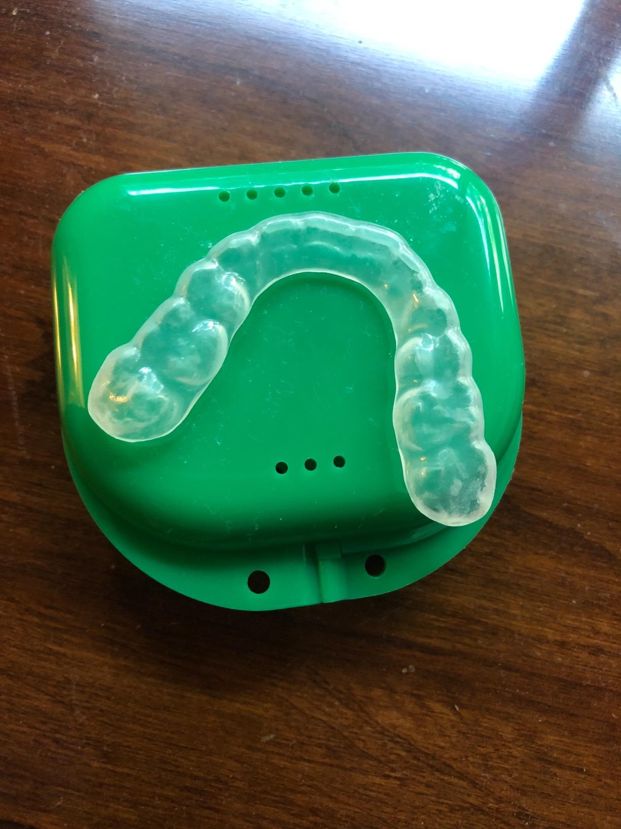 enCore Custom Soft Mouth Guard for Grinding & Clenching Teeth at Night | At-Home DIY Dental Impression Kit | Single Guard Fabricated for Perfect Fit & Lasting Protection | For Mild Bruxism customer photo 2