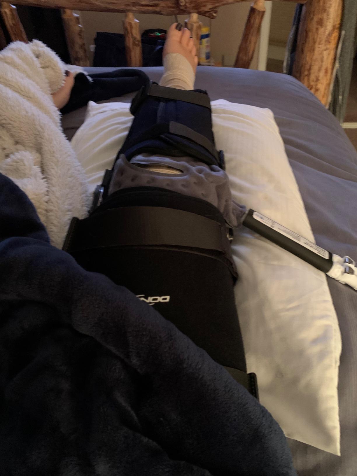 Vive Ice Machine for Knee & Shoulder After Surgery - Cold Therapy for Hip Replacement - Large Cryotherapy Pad with Quiet Pump - Flexible Cuff Unit for Ankle, Cervical, Back, Leg, ACL customer photo 2