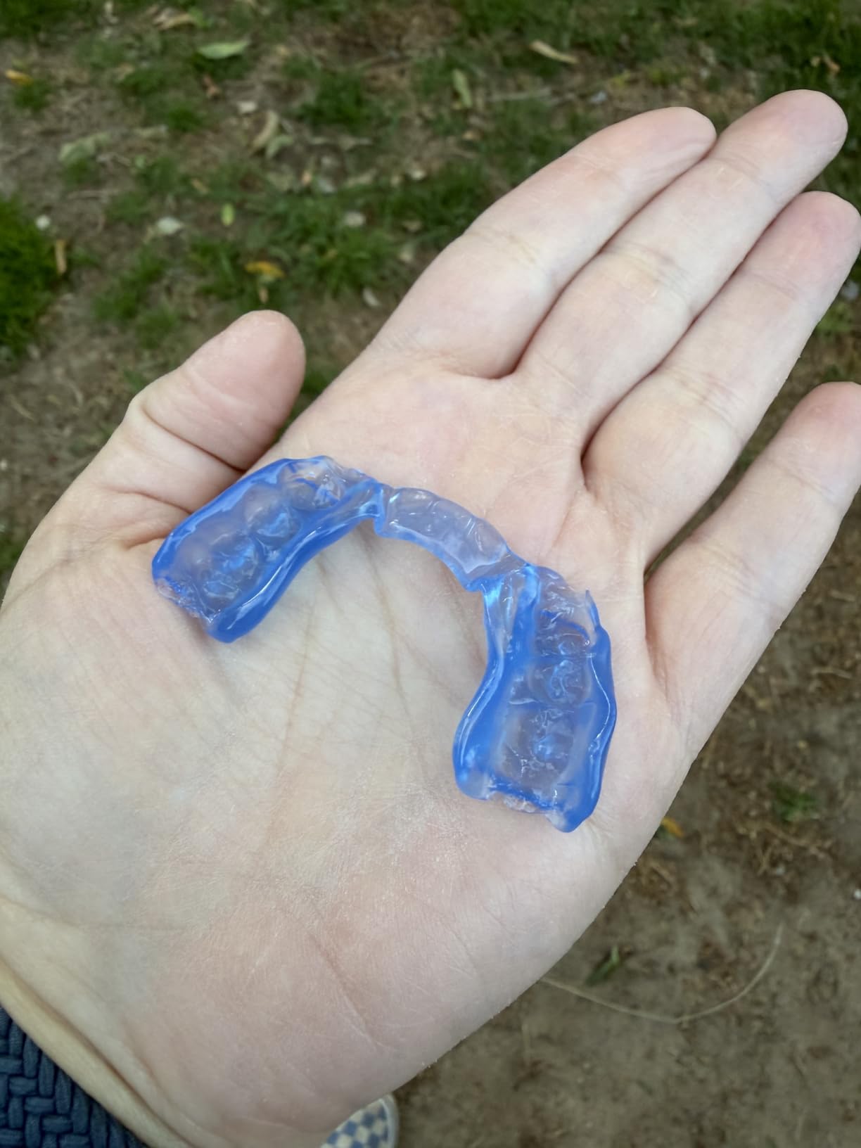 DenTek Ultimate Dental Guard, Slim-Fit Mouth Guard, 1 Count | BPA Free, FDA-Cleared, Mouth Guard for Grinding Teeth at Night, Custom Slim Fit, Teeth Grinding Protection customer photo 1