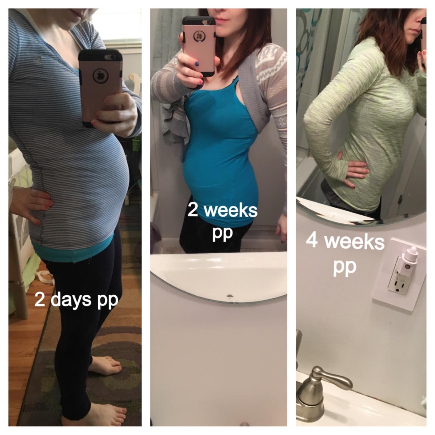 Postpartum Belly Band Support: 2 Adjustable Straps for Abdomen Compression | Helps Relieve Incision & Back Pain After C-Section during Getting Up, Coughing & Breastfeeding customer photo 2