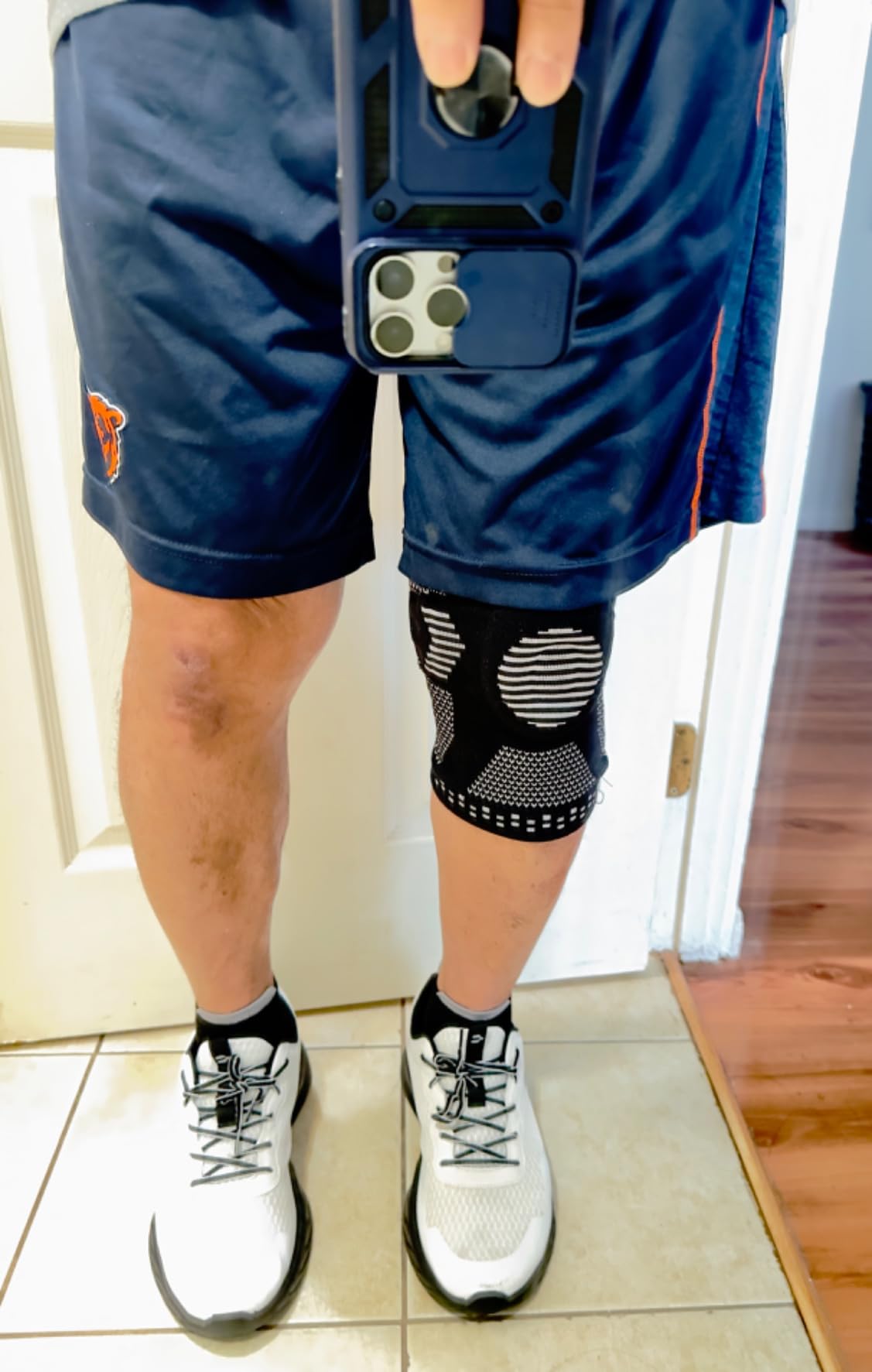 NEENCA Professional Knee Brace with Patella Gel Pad and Side Stabilizers customer photo 2