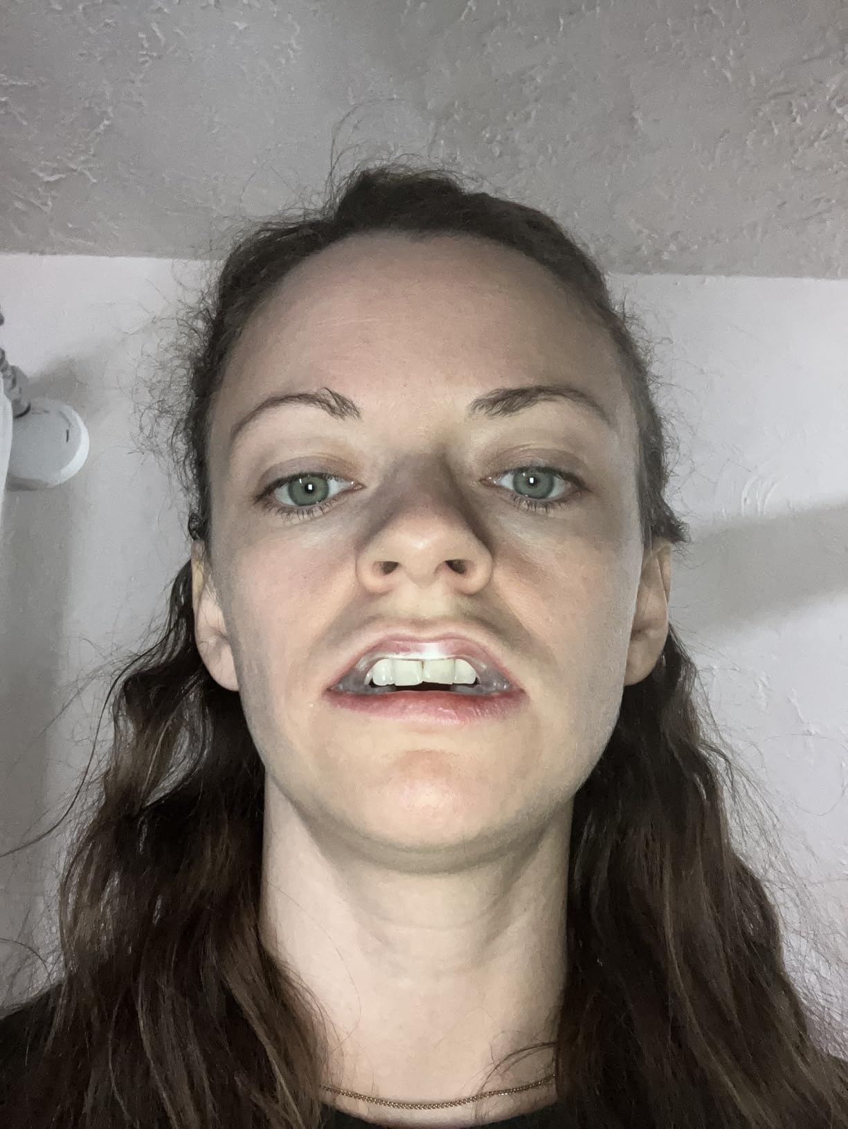 SleepRight Select-Comfort Night Guard for Teeth Grinding & Bruxism | No Boil Custom Fit Design with Secure Comfort customer photo 1