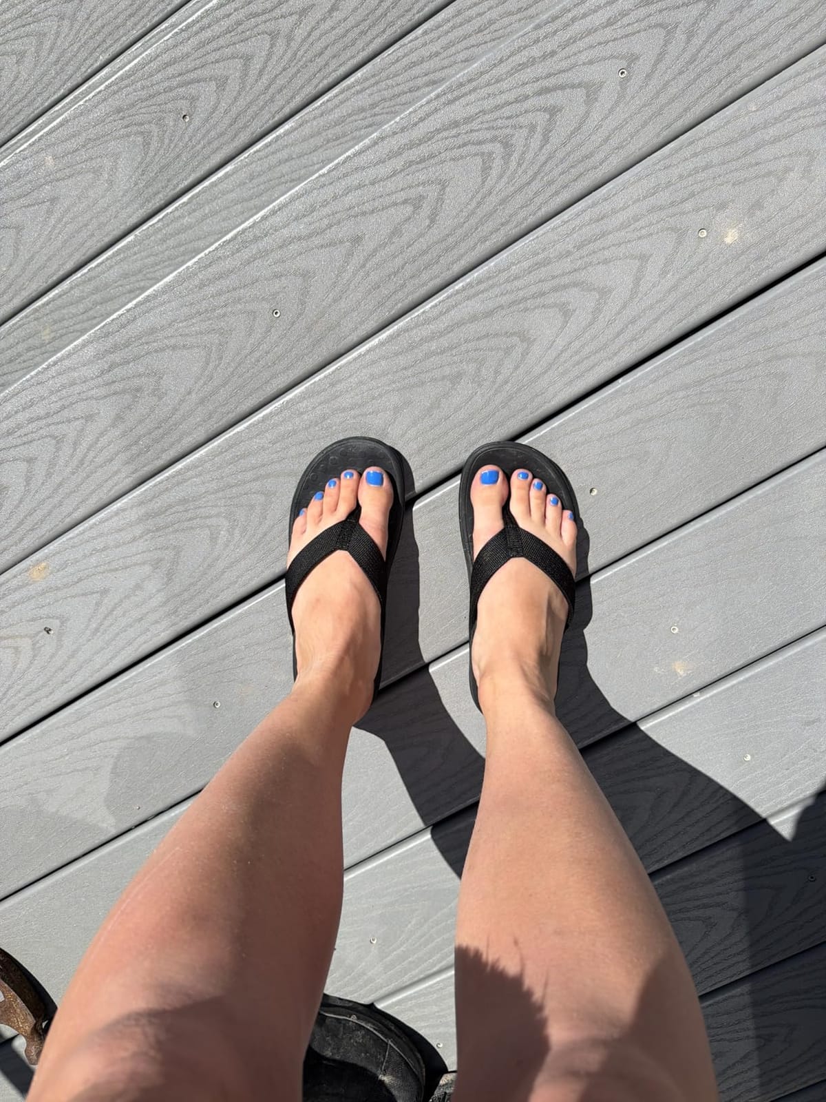 LLSOARSS Plantar Fasciitis Feet Sandal with Arch Support - Best Orthotic flip Flops for Flat Feet，Heel Pain- for Women customer photo 1
