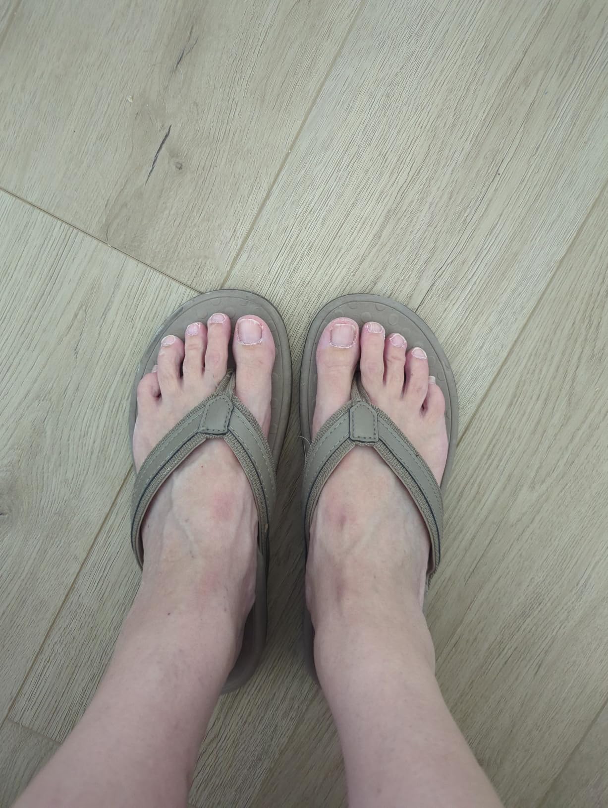 LLSOARSS Plantar Fasciitis Feet Sandal with Arch Support - Best Orthotic flip Flops for Flat Feet,Heel Pain- for Women customer photo 2
