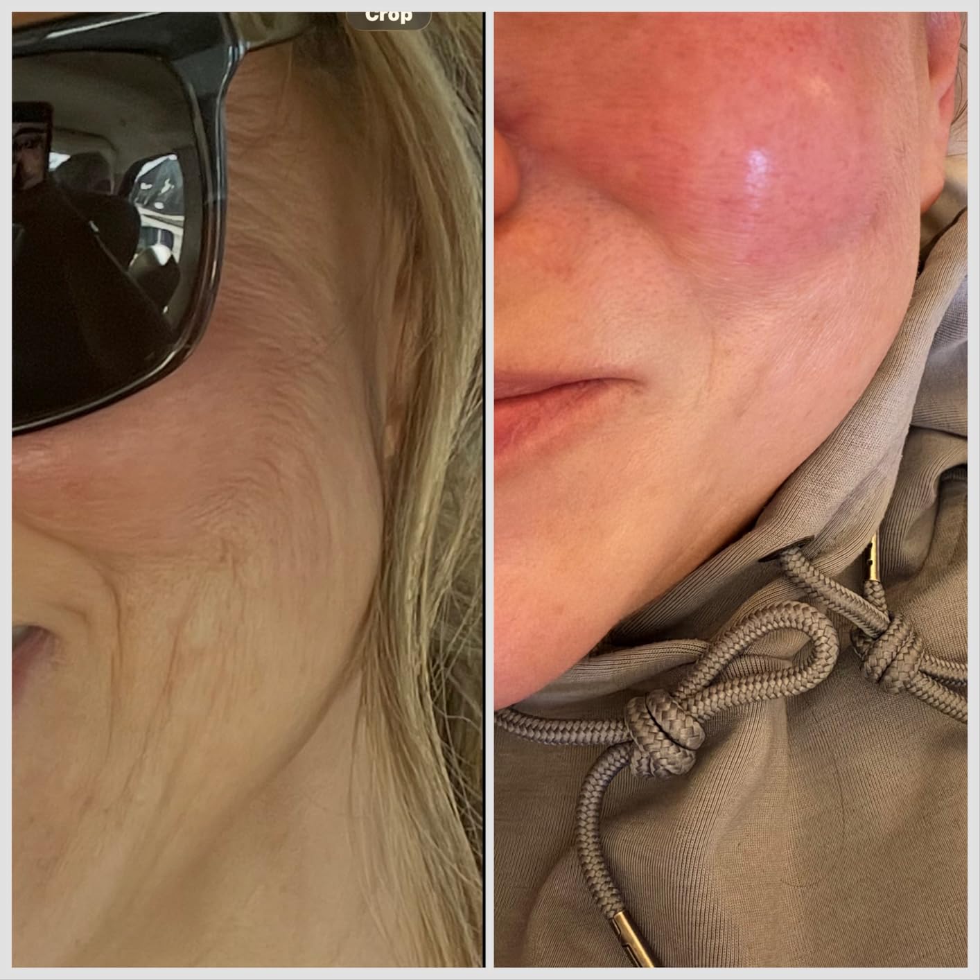 RoC Retinol Correxion Deep Wrinkle Retinol Face Serum, Ascorbic Acid, 1 0z customer photo 2