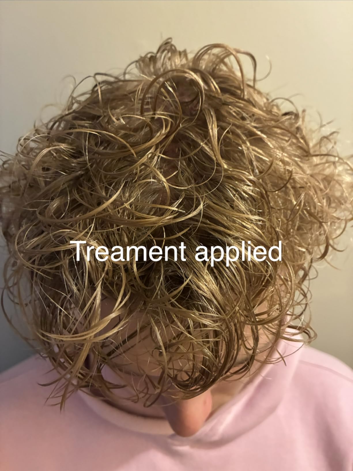 Elizavecca Cer-100 Treatment customer photo 1