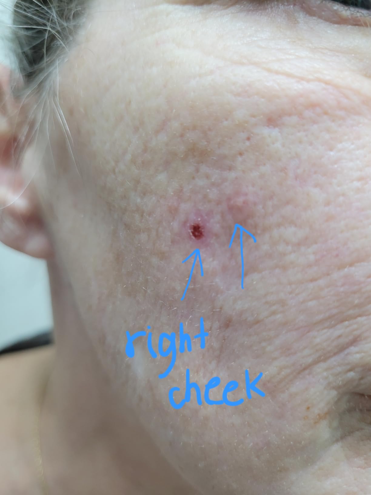 CeraVe Retinol Serum customer photo 1