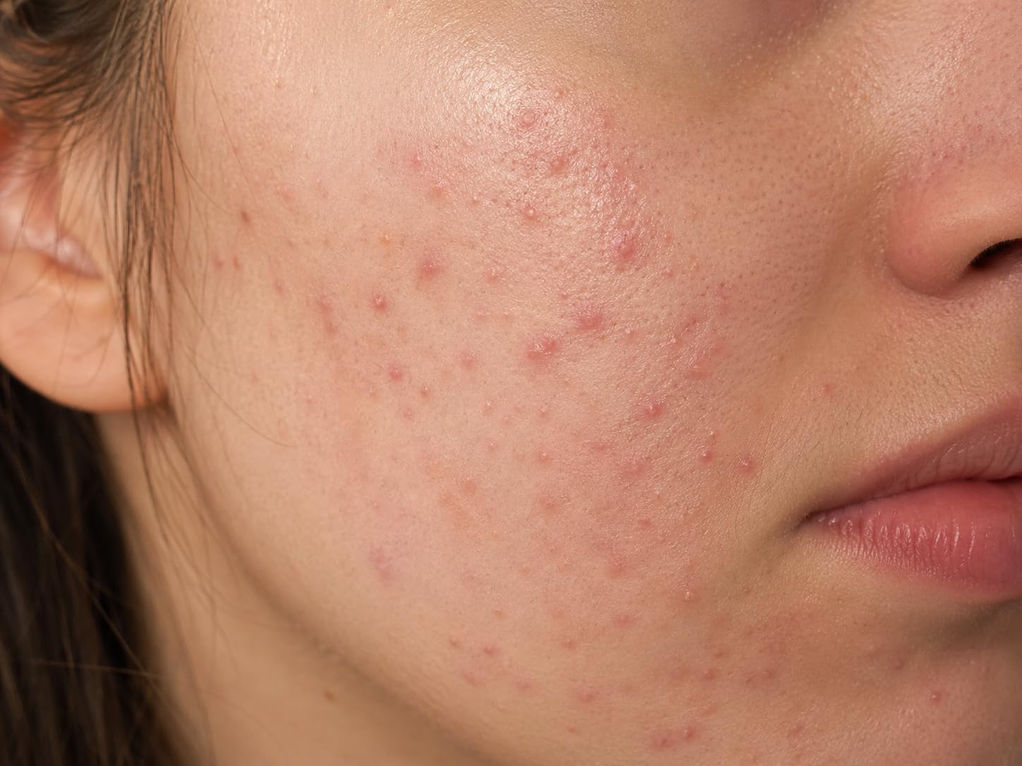 The Ordinary Glycolic Toner customer photo 1